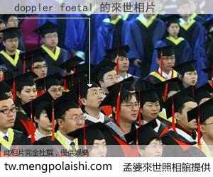 doppler foetal 來世的未來相片